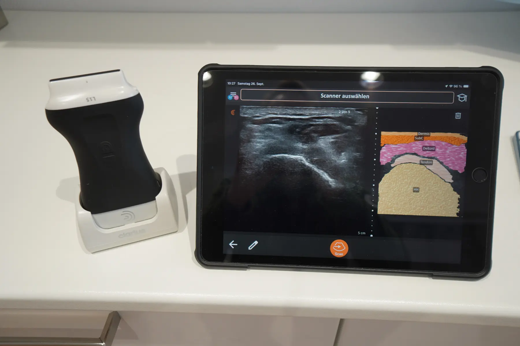 Portables Clarius Ultraschallgerät mit iPad
